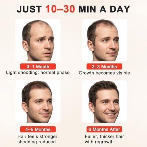 Red Light Therapy for Hair Growth,528 Total Light Emitters,Full-Scalp Coverage,Laser Hair Growth Cap,Blue - Thumbnail 5