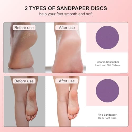 VISDOLL 2026 Upgraded Electric Foot Callus Remover, 3-Speed Ergonomic Rechargeable Pedicure Tool for Dry Skin, Cracked Heels, Dead Skin & Calluses, 20 Disposable Sandpaper Discs - Pink - Thumbnail 4