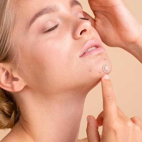Pimple Patches for Face,Acne Patches for Face,Pimple Patch,Zit Patches,Hydrocolloid Blemish Patches for Covering Zits ,with Salicylic Acid,Tea Tree oil & Calendula oil (106 Counts, Count, 106.0) - Thumbnail 5