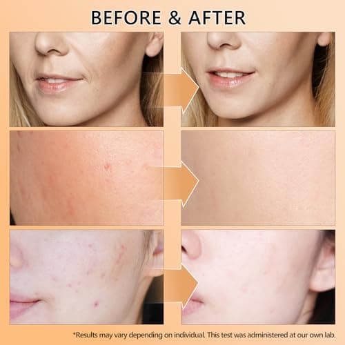 ABOTE Snail Mucin Face Serum 120ml with Pure 96% Snail Secretion Filtrate, Deep Hydration, Refreshing Skincare for All Skin Types (4.06 fl.oz) Travel Pack Size - Thumbnail 5