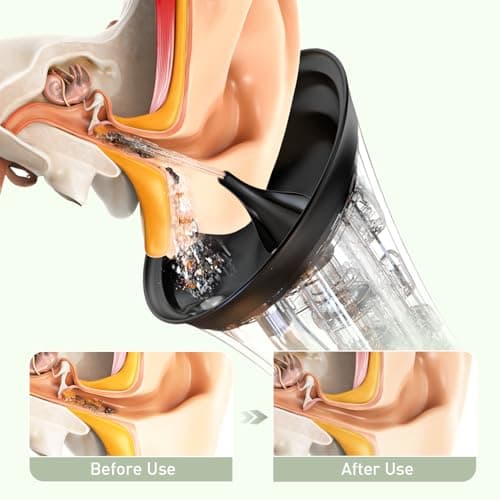 Ear Wax Removal - Electric Ear Cleaner with IPX7, Water Powered Ear Cleaning Tool with Irrigation Flusher, 6 Tips, 4 Pressure Settings - Safe & Effective for Ear Wax Cleaning Gifts for Women Men - Thumbnail 2