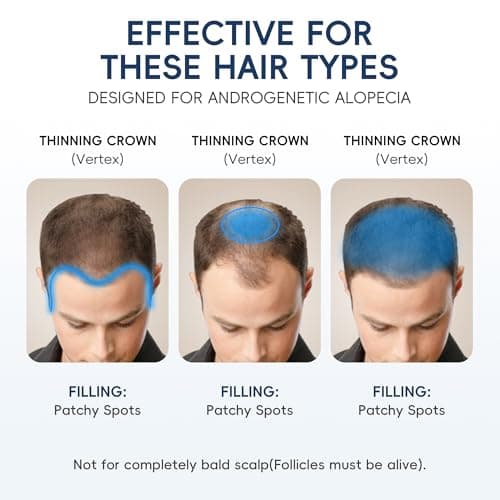 NDC Listed 5% Minoxidil for Men Hair Growth Serum Caffeine & Rosemary - Unscented, Fast-Absorbing Roll-On for Hair Loss Topical Treatment with Biotin, 3x20ml - Thumbnail 5