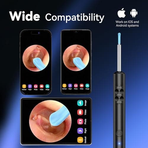 1080P HD Ear Camera with 6 LED Lights - Waterproof Rechargeable Otoscope Tool, Ear Wax Removal Kit with 8Pcs Ear Care Set for iOS & Android - Thumbnail 6