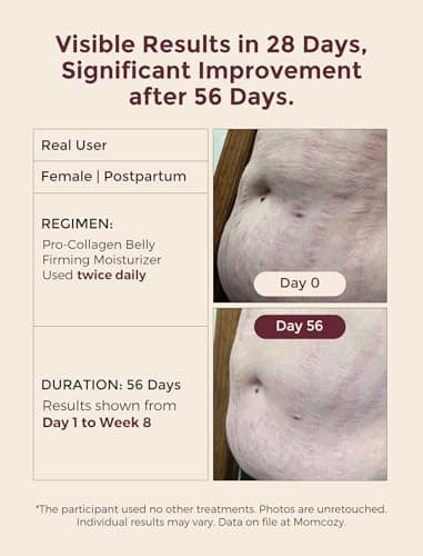 Momcozy Belly Cream 5-Day Trial Pack, EWG Verified, Clinically Tested Anti Stretch Mark Moisturizer, Peptides & Organic Herb Oils, Dermatologist Tested, 0.9 oz (5 x 5g Sachets) - Thumbnail 2