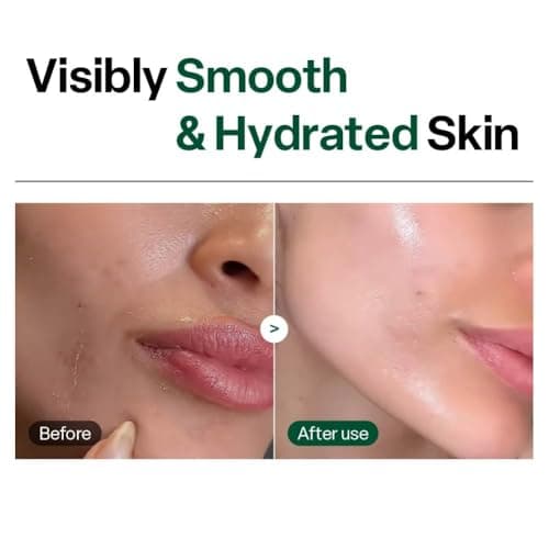 Dr. G Brightening Peeling Gel - Korean Skincare for Glowy Skin - Aqua Gommage Facial Exfoliator - Hyaluronic Acid, Ceramides, Vitamin C - Smooth Skin Texture, Low Irritation - Bulk Items - 4.23 fl oz - Thumbnail 5