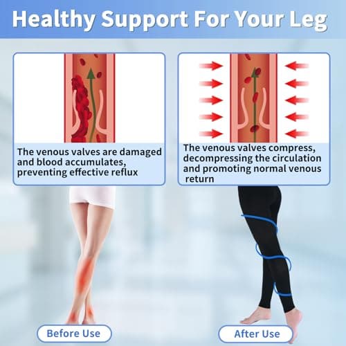 Medical Compression Pantyhose for Women & Men, 20-30mmHg Graduated Support Compression Tights Footless Medical Compression Stockings & Leggings for Edema, Varicose Veins, Swelling(Black,L) - Thumbnail 5