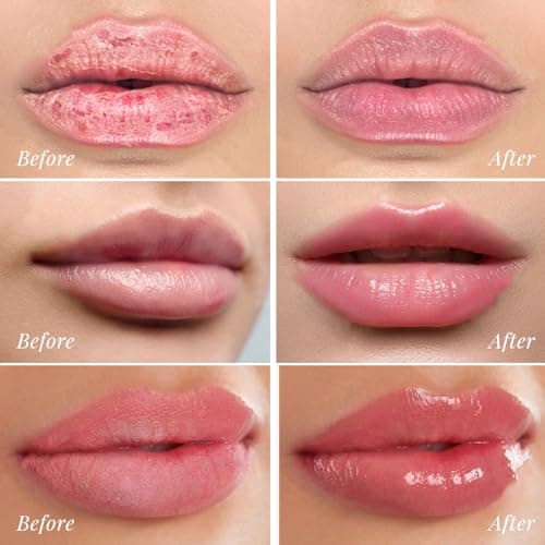 ANRCOLLECT Lip Mask Overnight Set, 4Pcs Lip Care Hydration Treatment Exfoliator Mask Kit, Revives & Nourishes Gift Set for All Day Moisturizing with Collagen & Shea Butter - Thumbnail 6