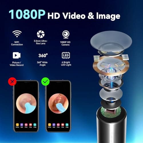 1080P HD Ear Camera with 6 LED Lights - Waterproof Rechargeable Otoscope Tool, Ear Wax Removal Kit with 8Pcs Ear Care Set for iOS & Android - Thumbnail 3