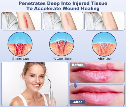 Infrared Red Light Device for Joints & Muscles, 460:630:660:850:900nm Cold Sore, Portable Near Infrared Wand for Face & Body Mouth Nose Effective 2 in 1 Modes - Thumbnail 2