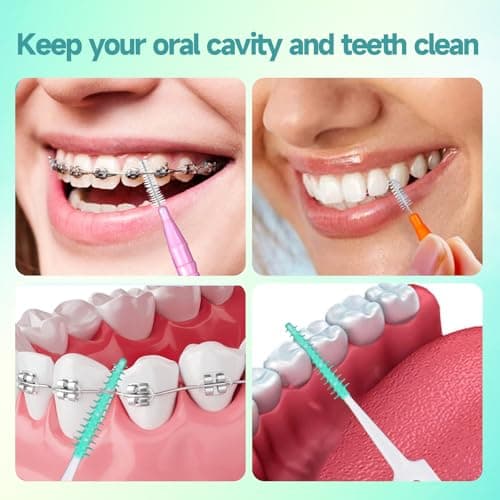 Maoerdental 360PCS Interdental Brushes,Disposable Soft Silicone Brace Brush,Bendable Dental Picks Braces flossing Teeth Cleaning Tools - Thumbnail 4