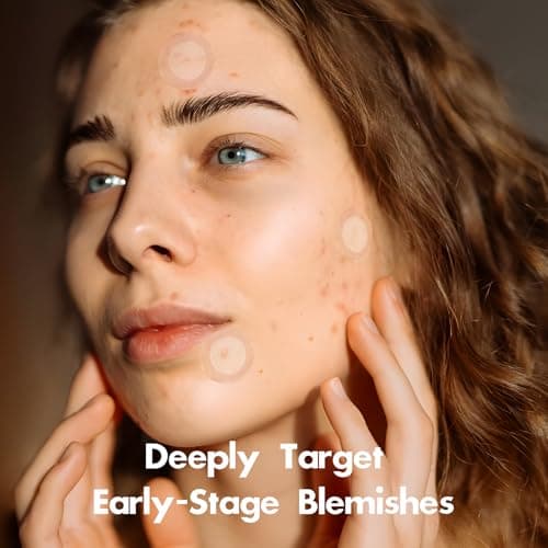 Dazzlook Microdart Pimple Patch for Deep Blemish, Hydrocolloid Zits Patch with Salicylic Acid, Nicotinamide, CICA, Tea Tree Oil Targe Early Stage & Underground Zit Breakout (16 Counts) - Thumbnail 2