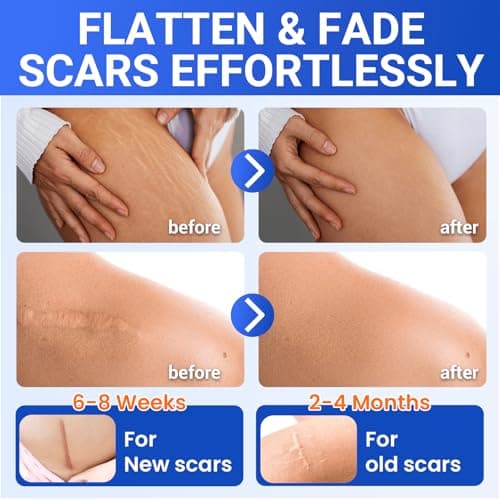 Silicone Scar Sheets Surgical Tape (1.6”x120” Roll) Face Patches Acne Treatment C Section Strips, Skin-Sensitive Medical Grade Healing Scar Bandages Pads for Keloid, Stretch and Tummy Tuck Recovery - Thumbnail 2