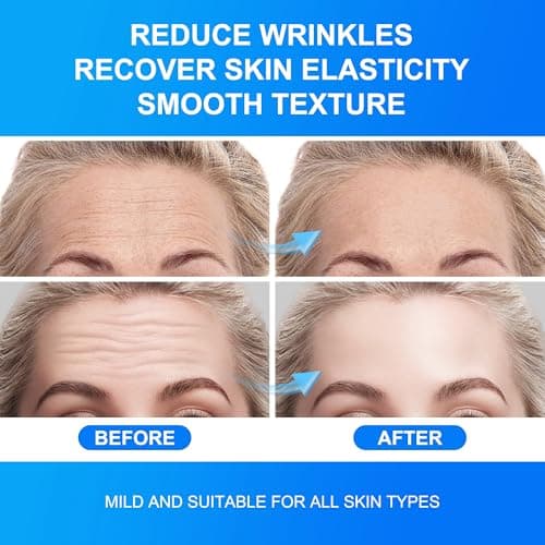 Auteek Forehead Wrinkle Patches Overnight 20pcs with Collagen & Seaweed Polysaccharides, Anti Wrinkle Patches for Smooth Fine Lines & Wrinkles, jelly forehead patches Treatment for Skin Care - Thumbnail 6