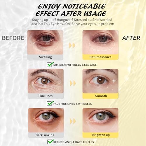 Maskiss Under Eye Patches (15 Pairs), 3 Colors Eye Masks Gift Set for Dark Circles Puffy Eyes, Undereye Bags and Wrinkles, Bachelorette Party Favors for Women, Skin Care Set Gifts Teen Girls - Thumbnail 3