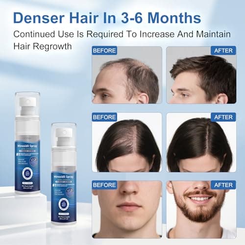5% Minoxidil for Men and Women, Regrowth Serum, Extra Strength Spray for Hair Loss, Minoxidil 5 Percent, Thicker Healthier Hair, Beard Growth Kit, Topical Treatment, 60ml x 7 Bottles（Extra Strength） - Thumbnail 3