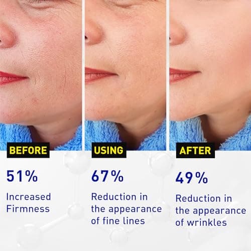 Vitamin C Face Serum for Anti Aging: Enaskin Naturals Super C Serum with Ferulic Acid for Women Mature Skin, Premium Formula Vit C Facial Serum for Brightening Dark Spots and Glowing up Skin - 1.7 Oz - Thumbnail 3