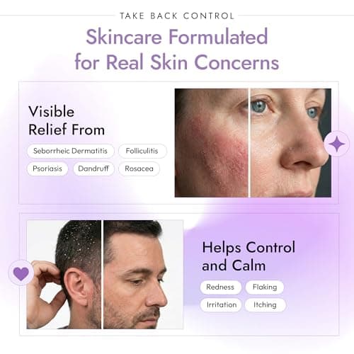 DERMAdoctor Seborrheic Dermatitis Shampoo – 2% Pyrithione Zinc Face Wash, Dermatologist Formulated Anti Dandruff Shampoo for Women, Itchy Scalp Treatment for Hair, Beard, Face & Body – 7.10 oz - Thumbnail 5