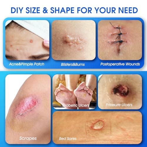 Medical Grade Hydrocolloid Roll for Wound Care, 2in*6.5ft Adhesive Hydrocolloid Bandages, Waterproof Pimple Patch Roll, Ultra Absorbent Large Hydrocolloid Patch for Acne, Blisters,Burns,and Minor Cuts - Thumbnail 3