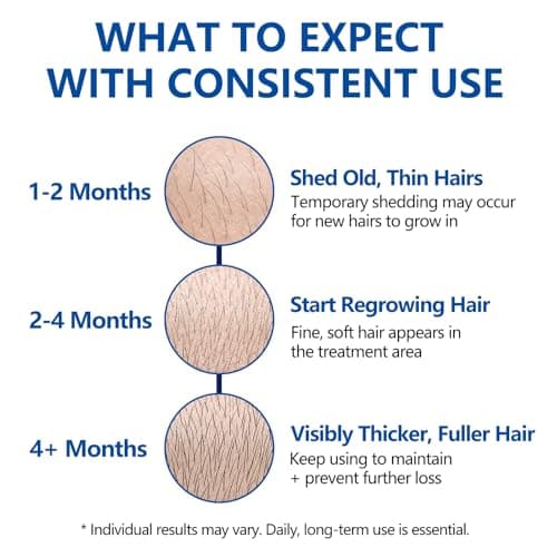 5% Minoxidil Hair Growth Cream for Men & Women - Biotin & Caffeine Scalp Cream Hair Regrowth Treatment for Thinning & Hair Loss, Non-Greasy, 3.5oz - Thumbnail 5