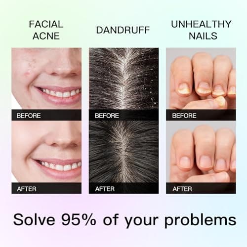 QONG Lavender Essential Oil Blend, Essential Oil, Essential Oils Organic, Used for Sleep, Hair Growth & Scalp Care, Essential Oils for Diffusers for Home 10ML - Thumbnail 2