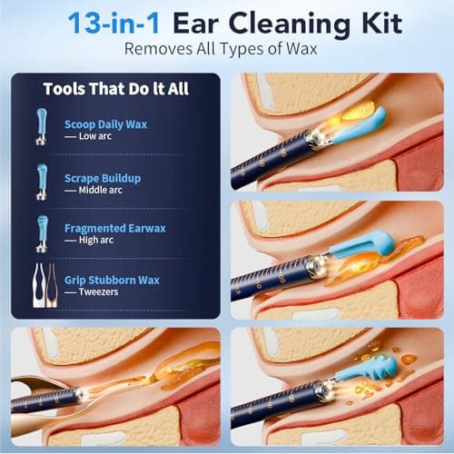 Ear Wax Removal, Ear Cleaner with Camera 1296P HD,Visual Ear Cleaner with 6 LED Lights and Flexible Tip,FSA HSA Eligible Items,Safe Ear Wax Removal Kit with Camera,Ear Cleaning Tool for Family Gifts - Thumbnail 2