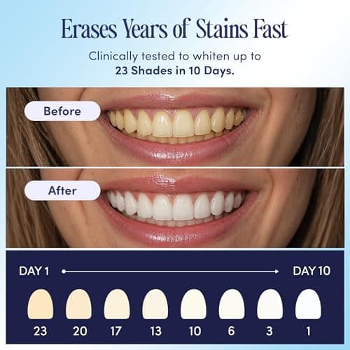 Boca Bella Teeth Whitening U-Wraps – 10 Treatments – 15% Hydrogen Peroxide, Enamel-Safe, No Harsh Sensitivity – Patented Strip Design with Aloe, Calendula & Peppermint – Fast, Even Whitening - Thumbnail 5