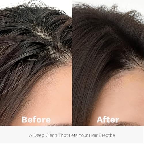 DORPANG Restore Shampoo for Thinning Hair for Women and Men, Peptide Shampoo with AnaGain™, Clinically Formulated to Fuller-Looking Hair & Scalp Balance, Sulfate-Free, 12 fl oz (355ml) Floral Scent - Thumbnail 3