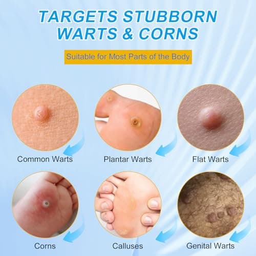 ZGjoib WART Corn Remover Pads for Feet 40% Salicylic Acid Wart Remover Pads, Corn Removers for Toes,Body - Thumbnail 3