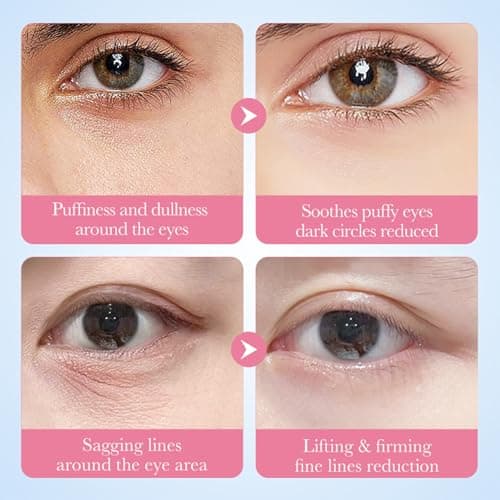 InfiniteRelax Under Eye Patches - 60 Pcs Eye Mask Anti-Aging Collagen Hyaluronic Acid Moisturizing Under Eye Mask for Removing Dark Circles, Puffiness - Thumbnail 5