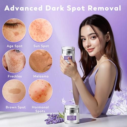 HANYWIL Dark Spot Remover for Face & Body, Remedy for Dark Spots with Natural Ingredients, Dark Spot Corrector Cream and Serum for Skin Care, Treats Freckles, Melasma, Sun Spots, Women & Men,1.7 Fl Oz - Thumbnail 3