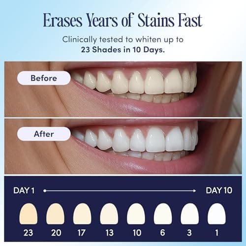 Boca Bella Teeth Whitening U-Wraps – 10 Treatments – 15% Hydrogen Peroxide, Enamel-Safe, No Harsh Sensitivity – Patented Strip Design with Aloe, Calendula & Peppermint – Fast, Even Whitening - Thumbnail 3