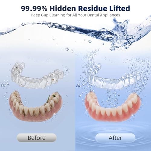 Ultrasonic Retainer Cleaner Machine, Denture Cleaner for Aligners Night Guards Braces Mouth Guards Toothbrush Heads，All-in-One Dental & Jewelry Cleaner, 45kHz 200ML, Dual Modes - Thumbnail 6