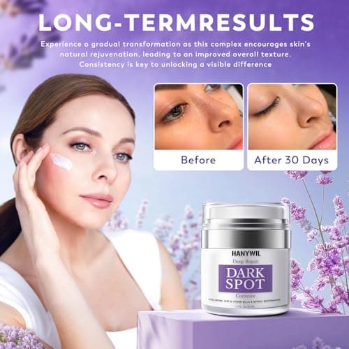 HANYWIL Dark Spot Remover for Face & Body, Remedy for Dark Spots with Natural Ingredients, Dark Spot Corrector Cream and Serum for Skin Care, Treats Freckles, Melasma, Sun Spots, Women & Men,1.7 Fl Oz - Thumbnail 2