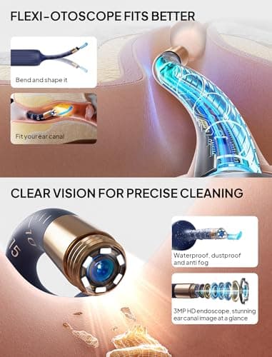 Ear Wax Removal Tool Camera, Visible Ear Cleaner Earwax Remover Kit with Tweezers, Flexible Ear Scope Otoscope with Light, Portable Cleaning Kit Earpick for Adults & Kids - Thumbnail 2
