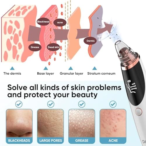 Blackhead Remover Pore Vacuum for Face and Nose, Facial Pore Cleanser with 3 Suction Levels, 5 Replaceable Tips, USB Rechargeable Tool for Blackheads and Whiteheads（White） - Thumbnail 3