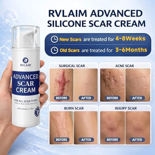 Rvlaim Silicone Scar Cream Scar Gel, Advanced Scar Removal Cream for Surgical Scars, Acne Marks, Stretch Marks, Keloids, C-Section, Burns, Old and New Scars, 1.7 fl oz - Thumbnail 2