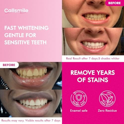 CALLSMILE Whitening Strips for Teeth Sensitive: 64 Strips Gentle Teeth Whitening Strips Enamel Safe Non-Slip Dry Strip Technology Residue Free Daily Oral Care, Coconut - Thumbnail 2