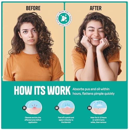 GoGleefy Pimple Patches for Face – Day & Night Acne Patches for Fast Healing, Skin Clarity – Invisible Hydrocolloid Patches, Waterproof Spot Treatment – All Skin Types Zit Patches of 60/120/180 - Thumbnail 6