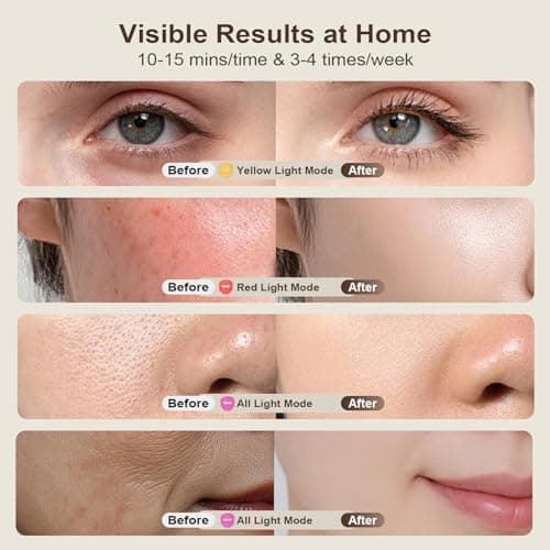 YHYXPO 4D Red Light Therapy Mask for Face,3 Modes Face Mask With 336 LEDs - Thumbnail 4