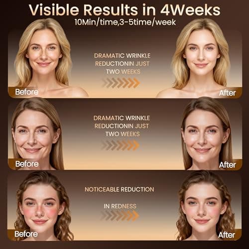 Red Light Therapy Mask for Face, Led Face Mask Light Therapy with 2000mAh Rechargeable Remote, LED Face Mask for Radiant Glow at Home, Black - Thumbnail 4