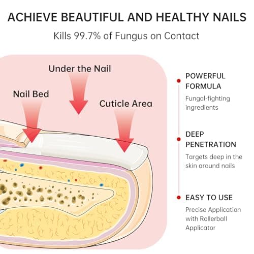 Nail Fungus Treatment Extra Strength – 1% Tolnaftate, Effective Treatment Under and Around Nails, Repairs Damaged Nails, Plant-Based Gentle Formula for Thickened and Discolored Nails, 0.51 fl.oz - Thumbnail 3