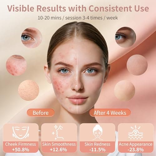 Red Light Therapy Mask for Face, Soft Silicone LED Face Mask with 4 Modes, 850nm Near Infrared and Red/Blue Light Therapy, 5000mAh Rechargeable, Adjustable Brightness & Timer for Radiant Home Skincare - Thumbnail 2
