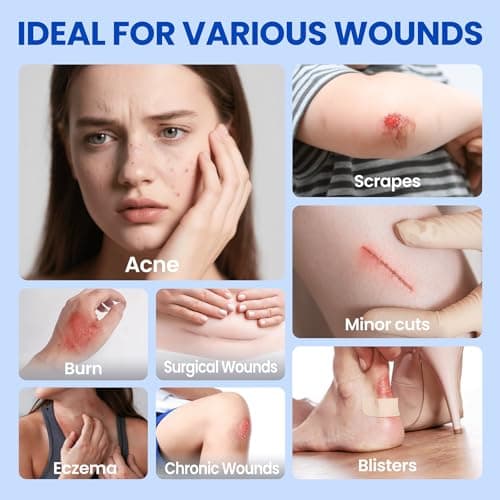Hydrocolloid Roll Large Adhesive Bandages Medical Grade Tape Wound Care Dressing, Cut-to-Size Waterproof Patches for Face Acne Pimple, Blister, Burn, Sterile & Fast Healing (2in x 12ft) - Thumbnail 3