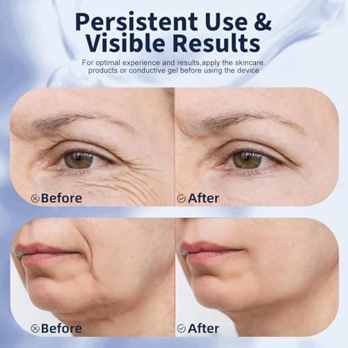 Red Light Therapy for Face, Multifunctional Face Massager with Micro-Current, LED Light Therapy & Vibration, at-Home Skin Care Face Sculpting Tool for Wrinkles, Micro-Current Facial Beauty Device - Thumbnail 4