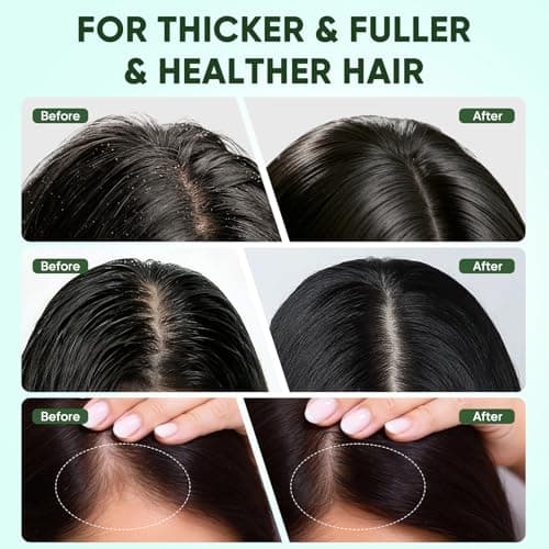 CADDISE Batana Oil for Hair Growth - 100% Pure & Natural Batana Paste from Honduras for Thicker & Fuller & Strong Hair, Organic Raw Batana Hair Mask for Women & Men, Fresh Scented, 4 oz - Thumbnail 4