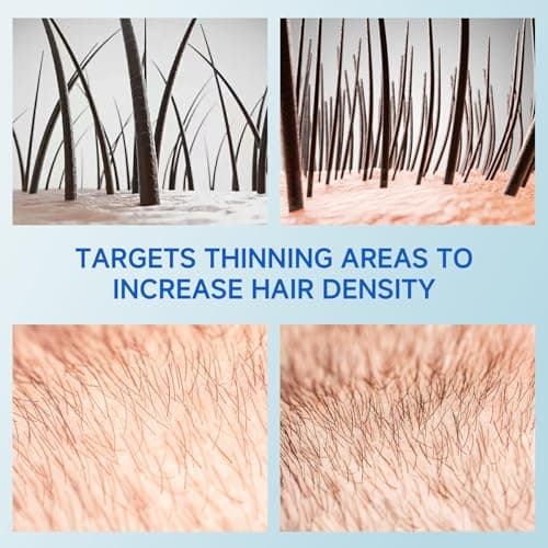 Hair Growth Serum Roll On, Rosemary Oil for Hair Growth, Be Roll On Rosemary Plant Essential Oils Extract Helps Support Body Thicker Fuller Hair for Men Women Pick - Thumbnail 4