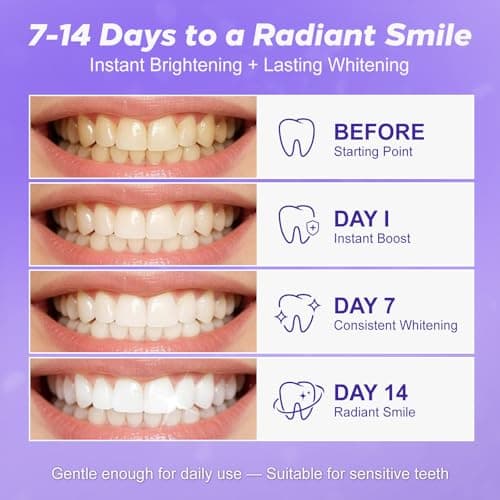 Purple Teeth Whitening Strips 28 Count - 14 Days Treatment Whitener Strips with Non Slip & Enamel Safe & Non Sensitive, Teeth Whitening Kit for Coffee, Wine Stains Removal Fastly (28 Strips - Purple) - Thumbnail 2