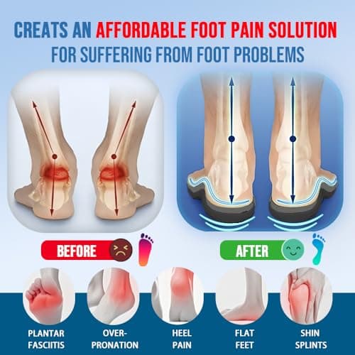AOBEKOS Heavy Duty Plantar Fasciitis Insoles Men Women, 240lbs Ultimate Comfort High Arch Support Shoe Inserts, Work Boot Orthotic Insoles for Plantar Fasciitis, Flat Feet, Pronation and Heel Pain - Thumbnail 2