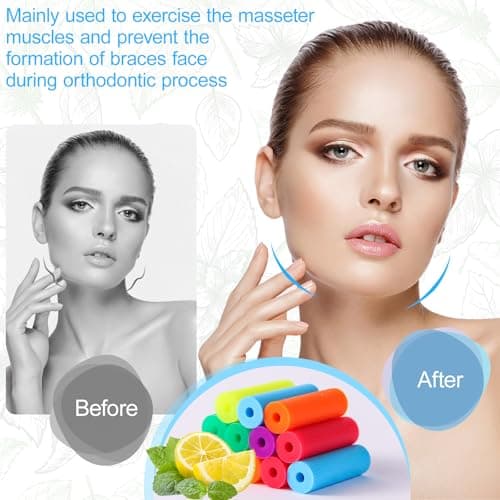 Maoerdental 12PCS Aligner Chew, Aligner Trays Chompers for Invisalign, Orthodontic Chompers Retainer Trays Seaters with Travel Carrying Case (Blue) - Thumbnail 4