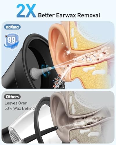 Ear Wax Removal, Electric Ear Cleaner with LED Display, FSA-HSA-Eligible, Ear Irrigation Kit with Dual Tank Includes 12 Tips, IPX7, Safe & Effective Cleaning for Adults & Kids, Easy to Use - Thumbnail 2